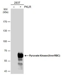 Pyruvate Kinase (liver/RBC) an