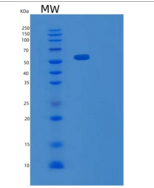 人补体成分C1q受体/C1QR1/CD93重组蛋白
