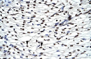 HIPK2 antibody, Internal