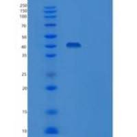 人白细胞介素18结合蛋白/白细胞介素18碱基对(C-Fc)重组蛋白