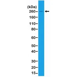 Acetyl-CoA Carboxylase 1 antib