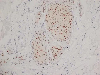 Progesterone Receptor antibody