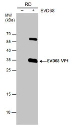 Enterovirus D68 VP1 antibody