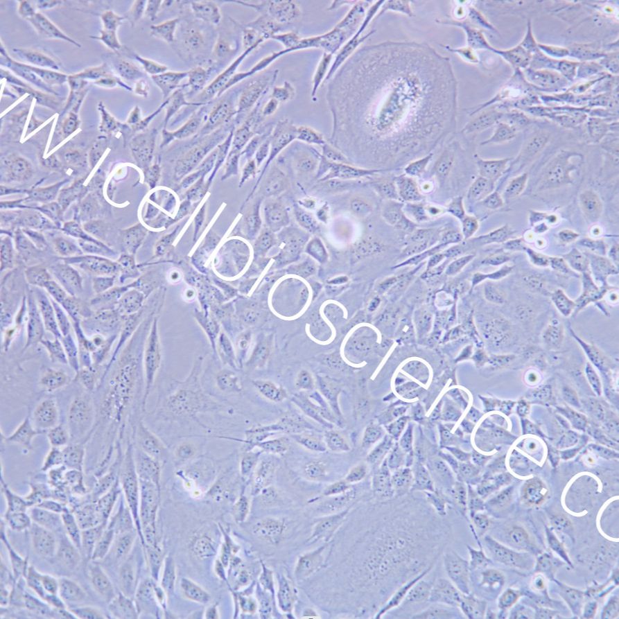 SVEC410 小鼠淋巴结内皮细胞/STR鉴定/镜像绮点（Cellverse）
