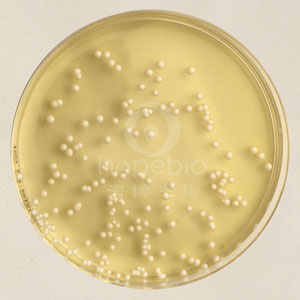 沙氏葡萄糖琼脂培养基（SDA） 颗粒	HBKP0253-81