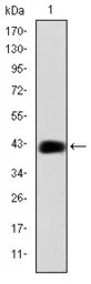 C/EBP beta antibody [3H9]