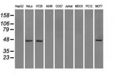 IDH1 antibody [2H9]