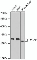 MTAP antibody