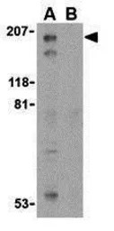 TSC2 antibody