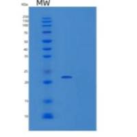 人淋巴毒素βR/LTBR/肿瘤坏死因子SF 3/肿瘤坏死因子rpv重组蛋白C-6His