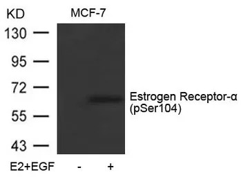 Estrogen Receptor alpha (phosp