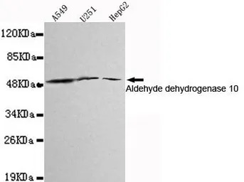 ALDH3A2 antibody [3F7-H9-E12]