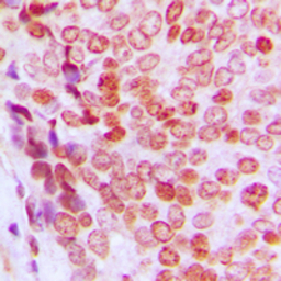 p21 Cip1 (phospho Thr145) anti