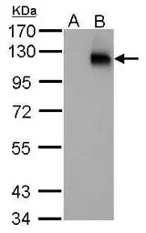 HIF1 alpha antibody [GT10211]