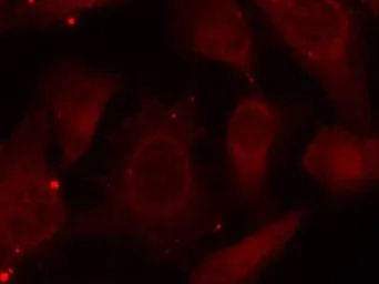 Merlin (phospho Ser518) antibo