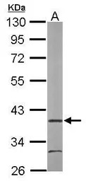 ARA9 antibody [N1C3]