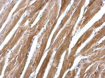 SGCE antibody [N1C1]