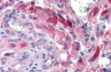 Apelin Receptor antibody