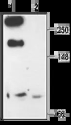 Cav2.3 antibody