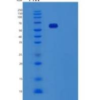 人纤维结合蛋白片段/逆结合蛋白/新结合蛋白重组蛋白
