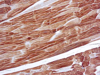 alpha Sarcomeric Actin antibod