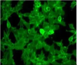 beta 2 Microglobulin antibody 