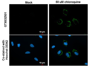 LC3B antibody [GT3612]
