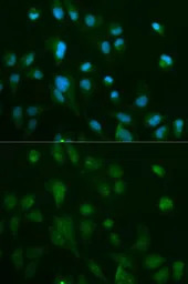 beta Arrestin 1 antibody