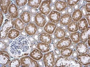 Pumilio 2 antibody [N1N2], N-t
