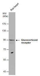 Glucocorticoid Receptor antibo