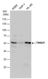 TRIM27 antibody
