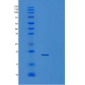 人肿瘤坏死因子α/肿瘤坏死因子α重组蛋白C-6His
