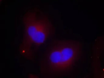 FAK (phospho Tyr925) antibody