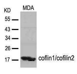 Cofilin1/Cofilin2 antibody