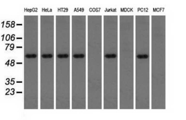 TXA synthase antibody [2C1]