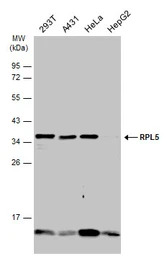 RPL5 antibody