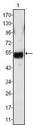 Fibrinogen beta antibody [1F9]