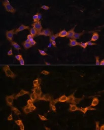 PDGF Receptor beta antibody