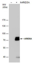 ARID5A antibody [GT921]