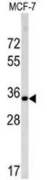 Emerin antibody, C-term
