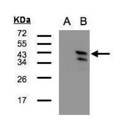 CaMKI delta antibody [N1C1]