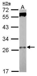 WDR61 antibody
