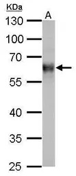 TrxR1 antibody