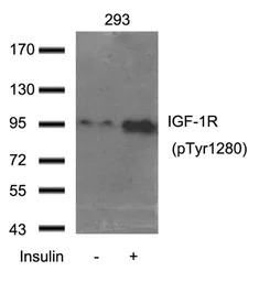 IGF1R (phospho Tyr1250) antibo