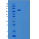 人肝配蛋白A受体2重组蛋白