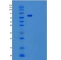 人肝配蛋白A受体2重组蛋白
