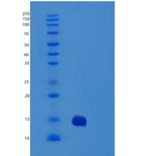 人特雷尔R2/TNFRSF10B/DR5/CD262重组蛋白C-6His