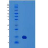 人特雷尔R2/TNFRSF10B/DR5/CD262重组蛋白C-6His