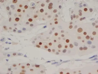 Progesterone Receptor antibody