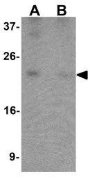B9D1 antibody